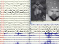 Shaking Attacks